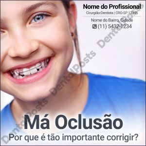 DentalPosts-modelo-146