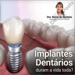 DentalPosts-modelo-159